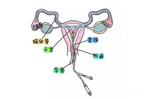 查输卵管做什么检查？这些检查可以帮助到您！
