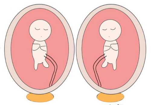 上海试管婴儿促排会怀双胞胎吗？理论上是可以实现的！