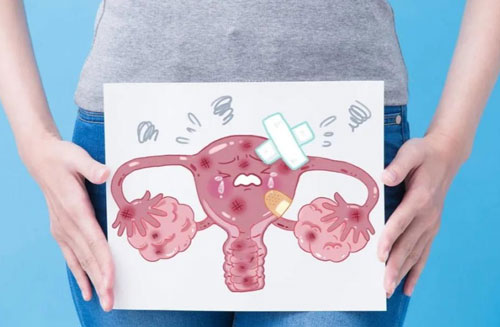 月经正常会多囊吗？月经来潮只代表你有排卵功能！